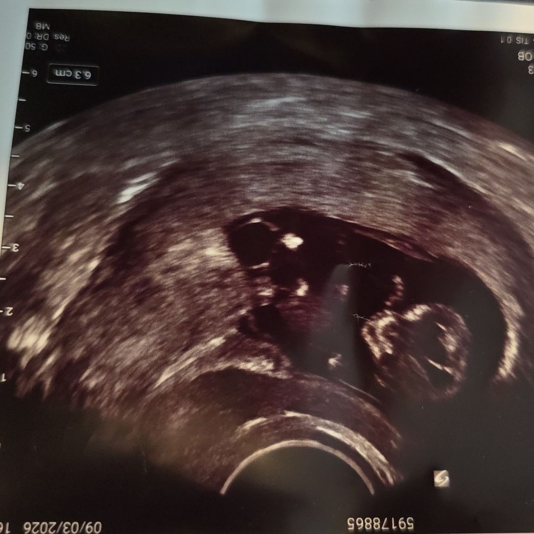 Photo shared by Miah for their Babylist baby registry.