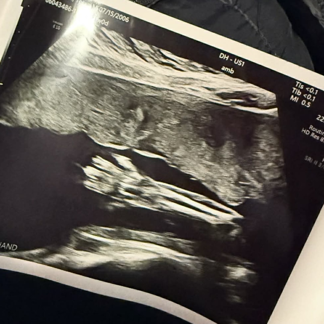 Photo shared by Tessa for their Babylist baby registry.