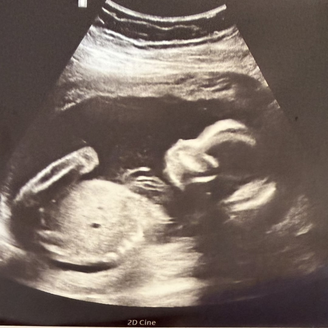 Photo shared by Allison for their Babylist baby registry.