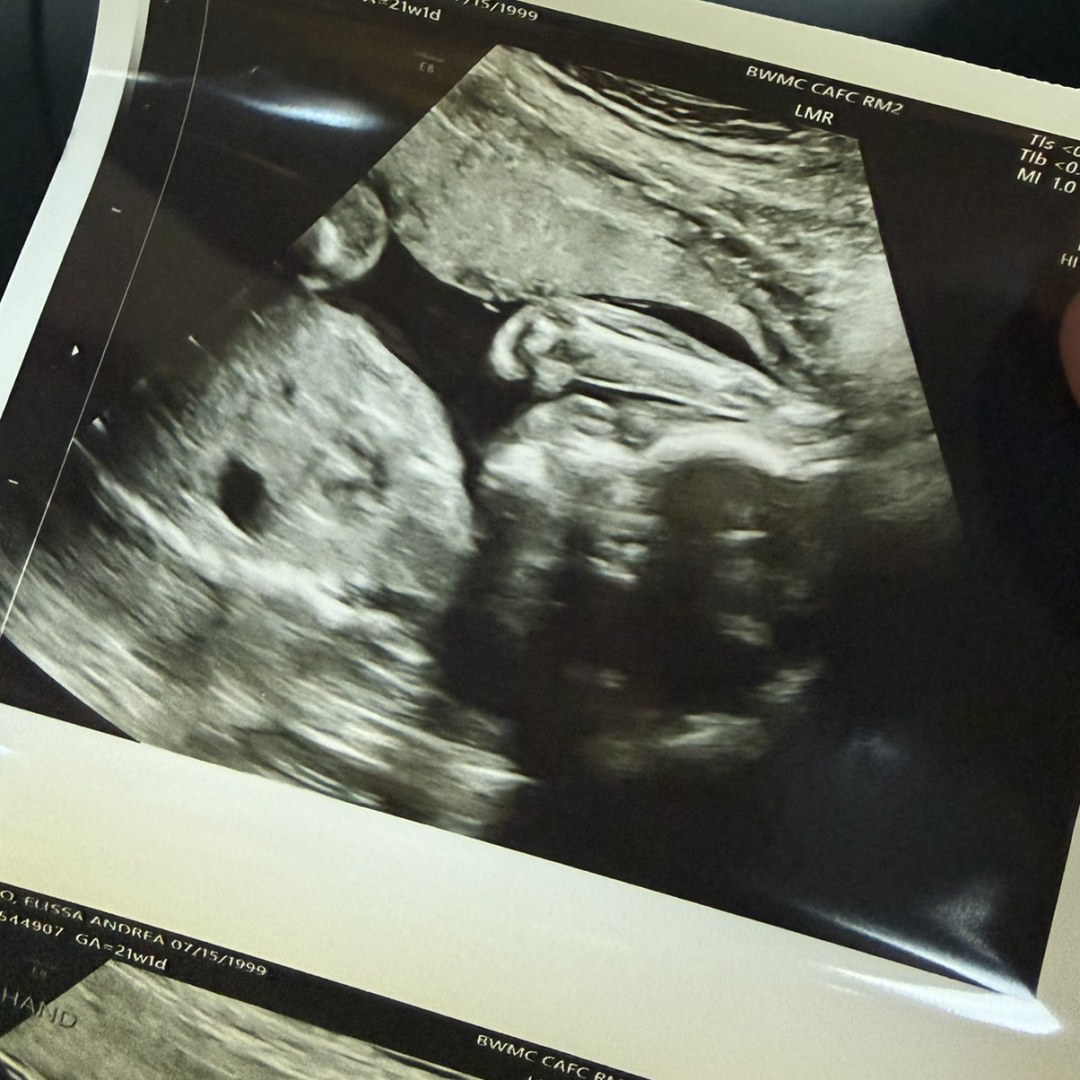 Photo shared by Elissa for their Babylist baby registry.