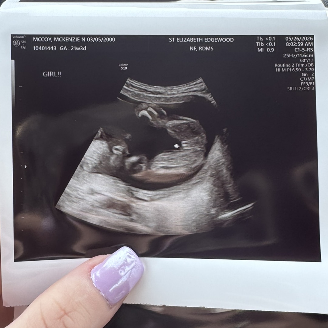 Photo shared by McKenzie for their Babylist baby registry.