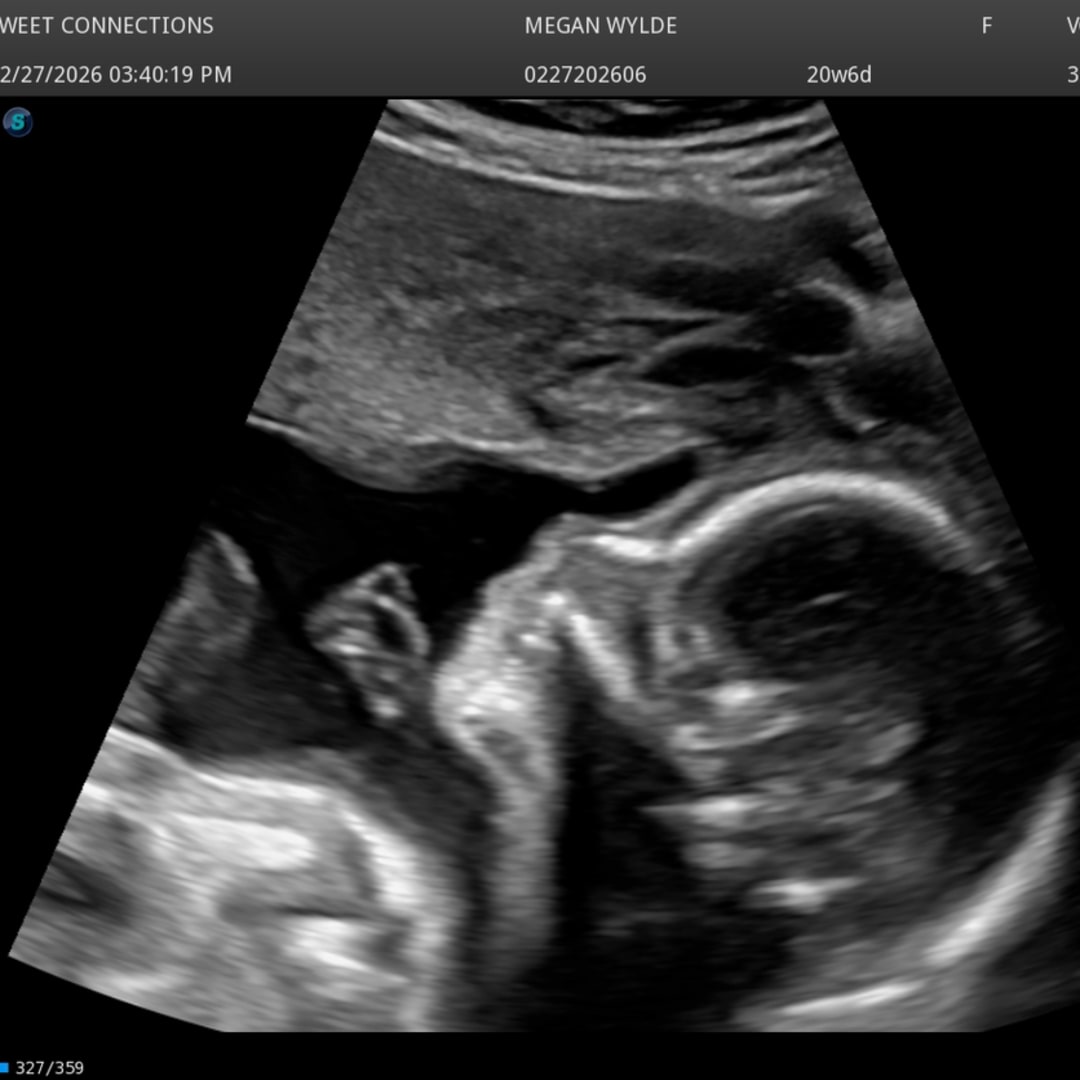 Photo shared by Megan for their Babylist baby registry.