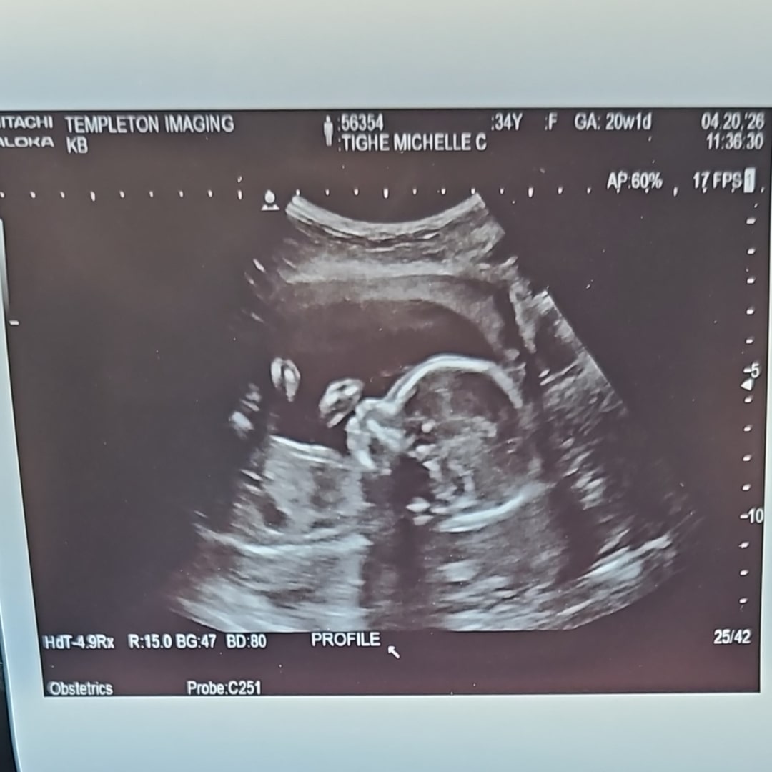 Photo shared by Michelle for their Babylist baby registry.