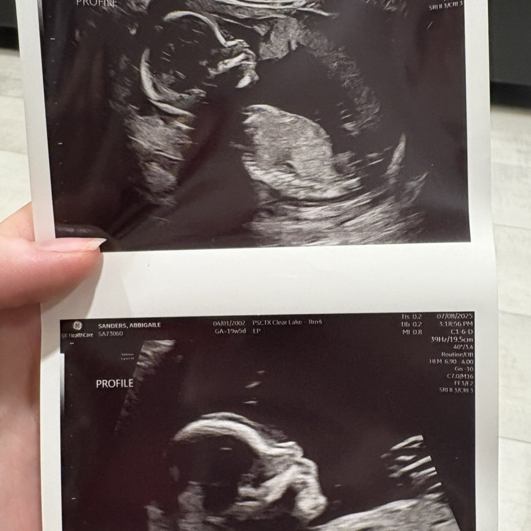 Photo shared by Abbigaile for their Babylist baby registry.