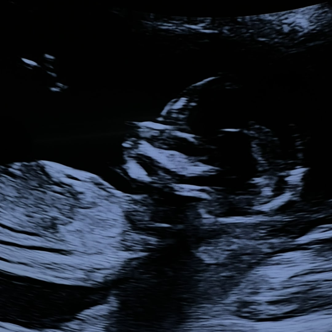 Photo shared by Everly for their Babylist baby registry.