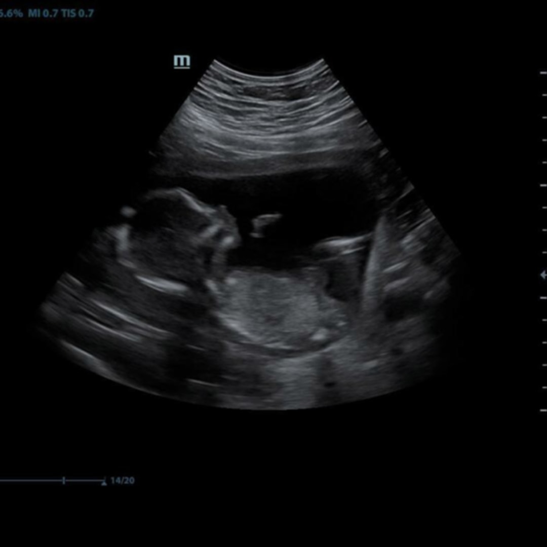 Photo shared by Monse for their Babylist baby registry.