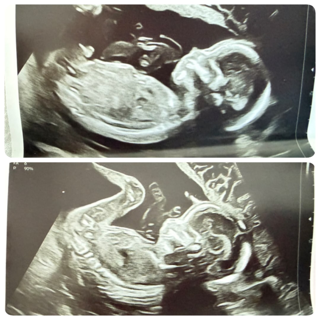 Photo shared by Amber for their Babylist baby registry.