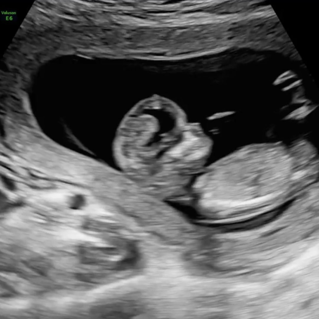 Photo shared by Alexus for their Babylist baby registry.