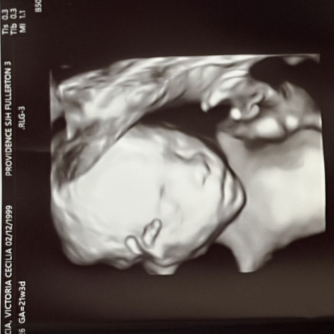 Photo shared by Victoria for their Babylist baby registry.