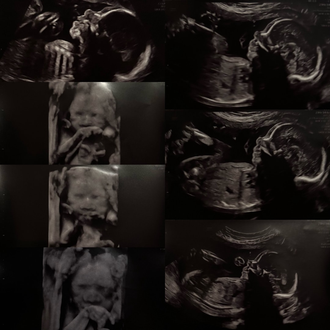 Photo shared by Emily for their Babylist baby registry.