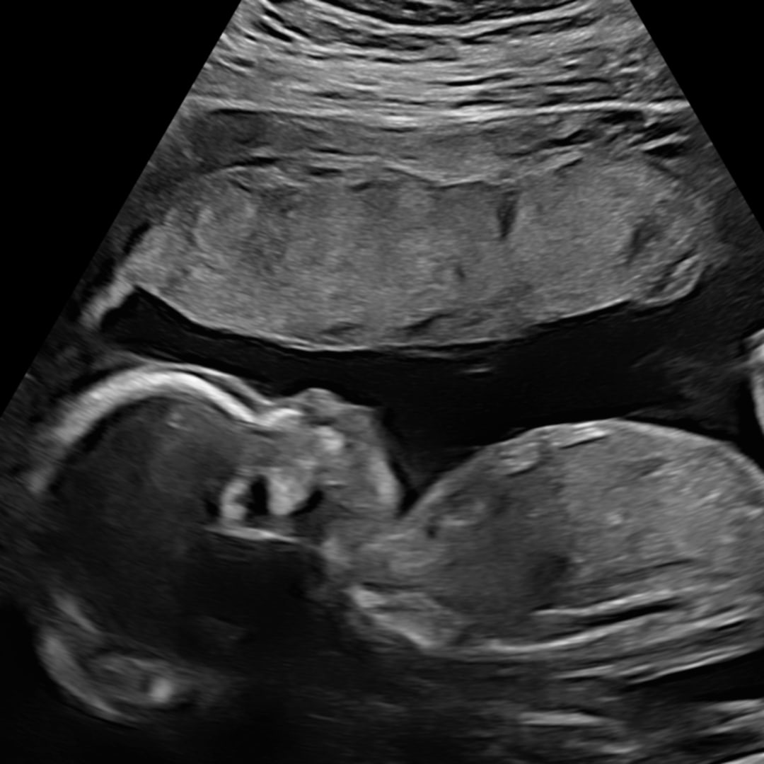Photo shared by Allie for their Babylist baby registry.