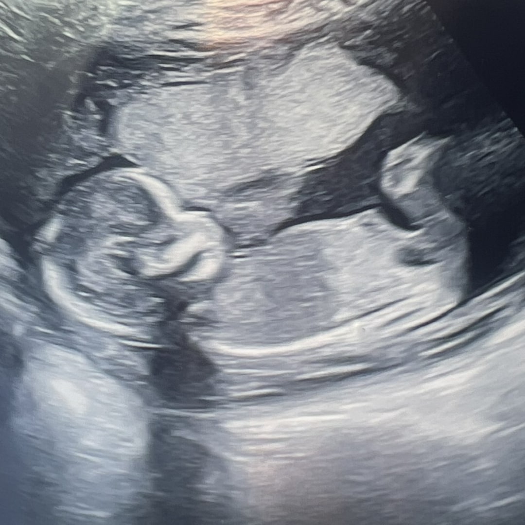 Photo shared by Darianne for their Babylist baby registry.