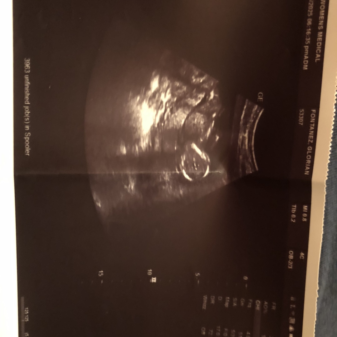 Photo shared by Glorian for their Babylist baby registry.