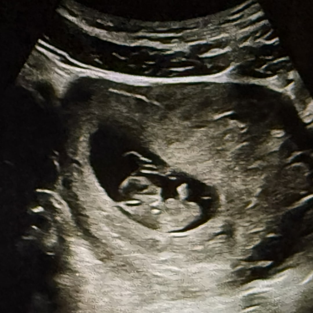 Photo shared by Ana Sofia for their Babylist baby registry.