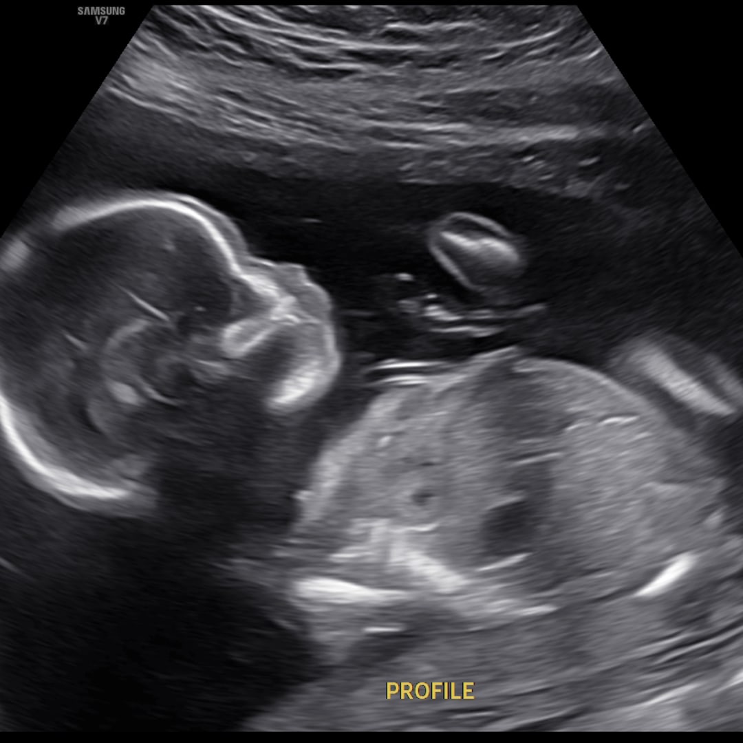 Photo shared by Brynn for their Babylist baby registry.