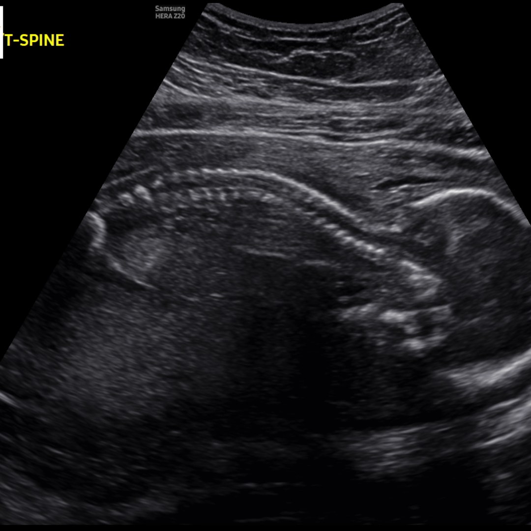 Photo shared by J-Ann for their Babylist baby registry.