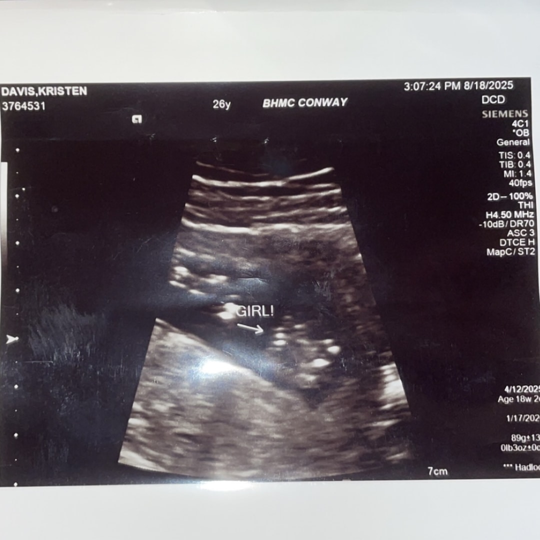 Photo shared by Kristen for their Babylist baby registry.