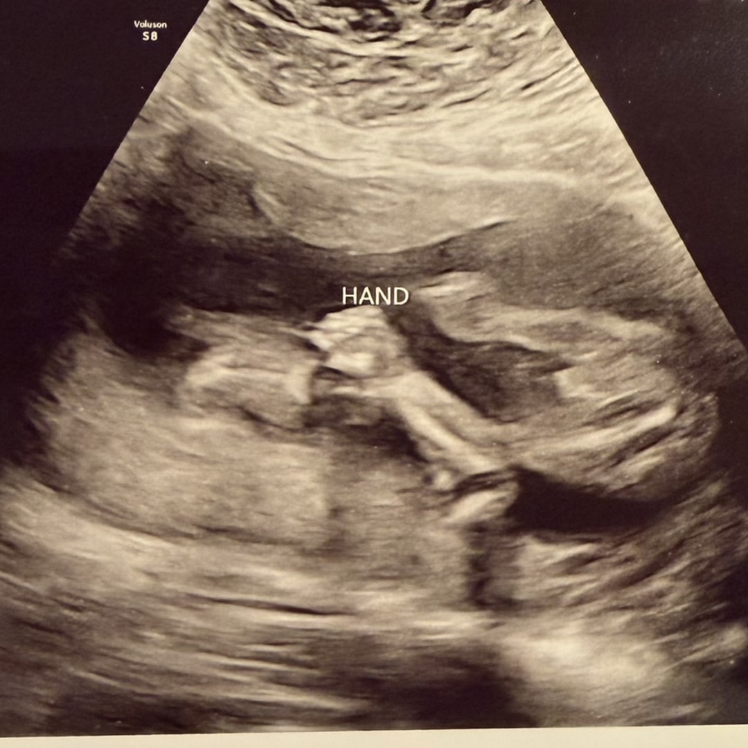 Photo shared by Myriah for their Babylist baby registry.