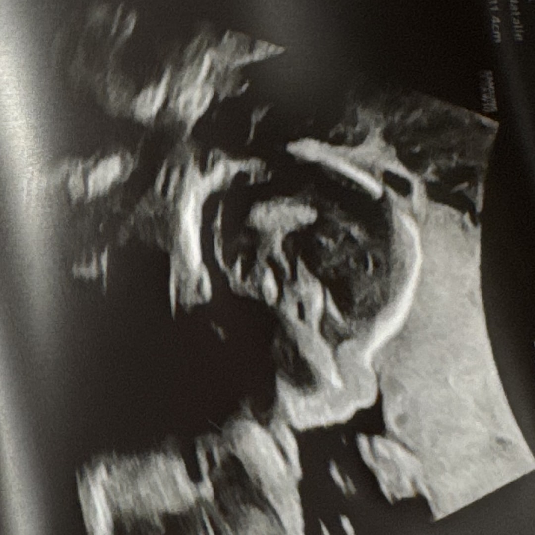 Photo shared by Natalie for their Babylist baby registry.