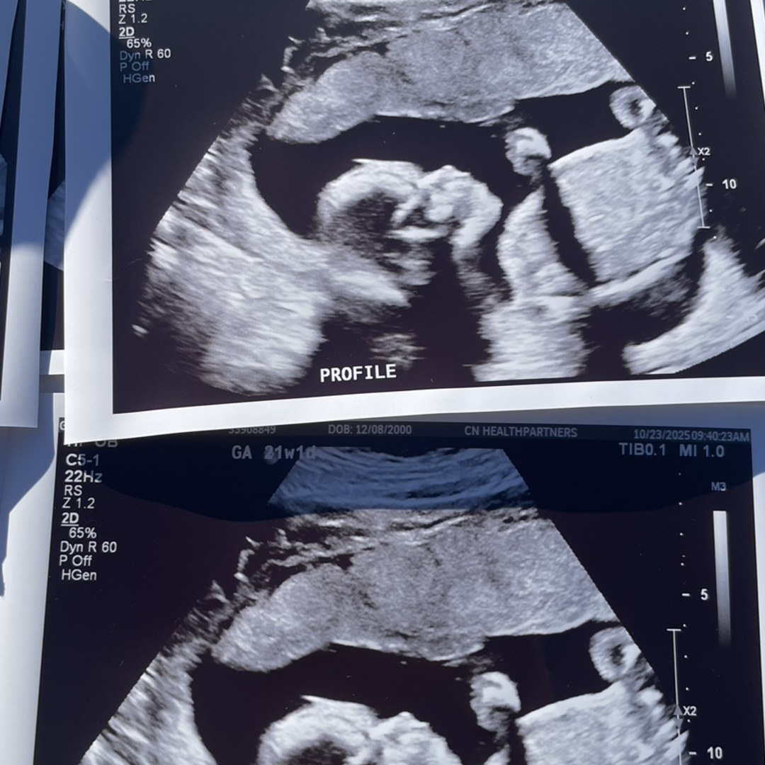 Photo shared by Autumn&Marisa for their Babylist baby registry.