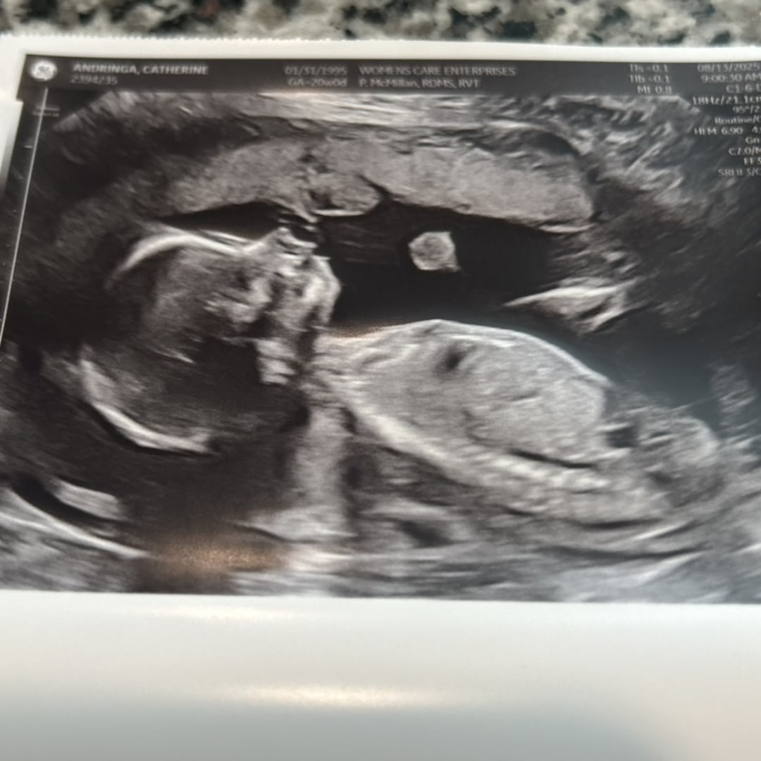 Photo shared by Paige for their Babylist baby registry.