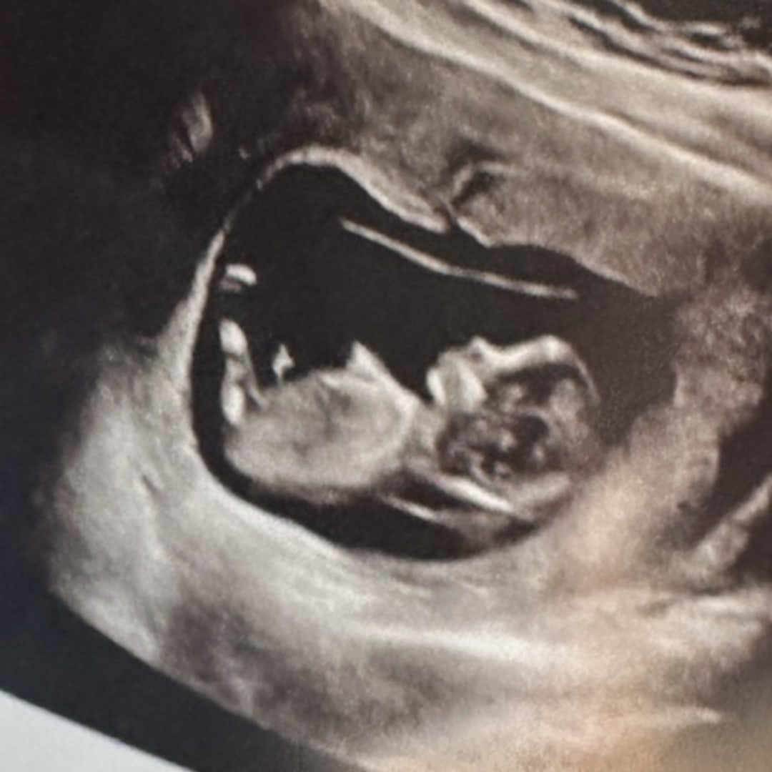 Photo shared by Hali for their Babylist baby registry.