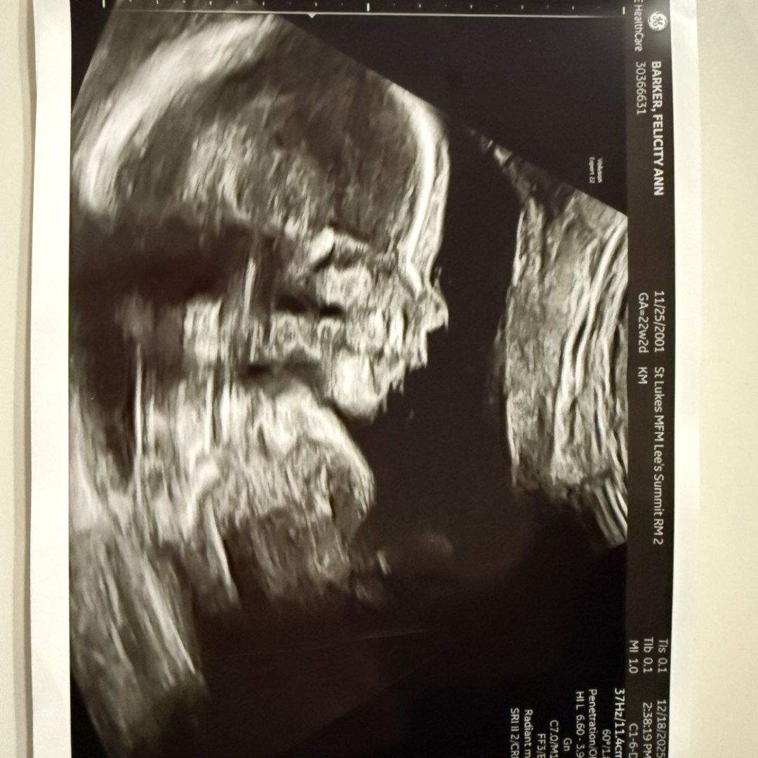 Photo shared by Felicity for their Babylist baby registry.