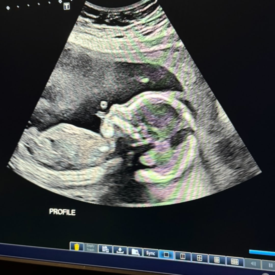 Photo shared by Haleigh for their Babylist baby registry.