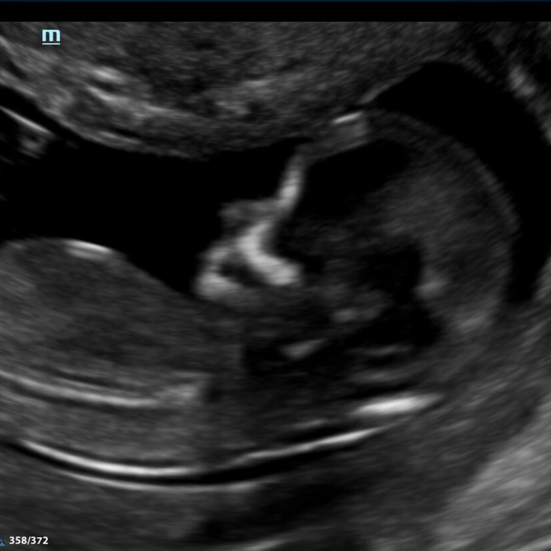 Photo shared by Lauren for their Babylist baby registry.