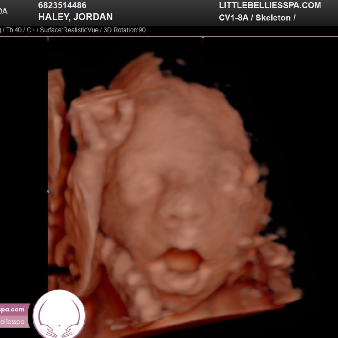 Photo shared by Jordan for their Babylist baby registry.