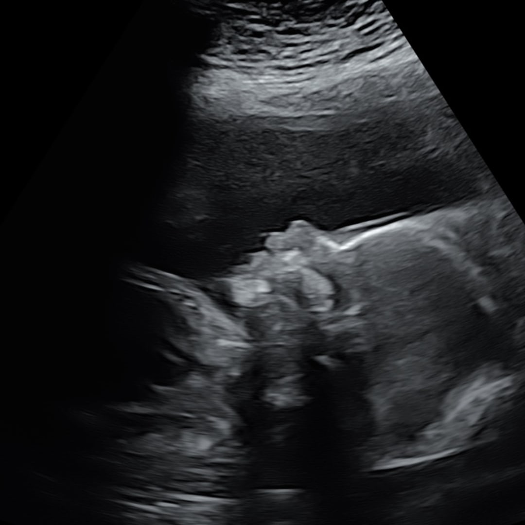 Photo shared by Hannah for their Babylist baby registry.