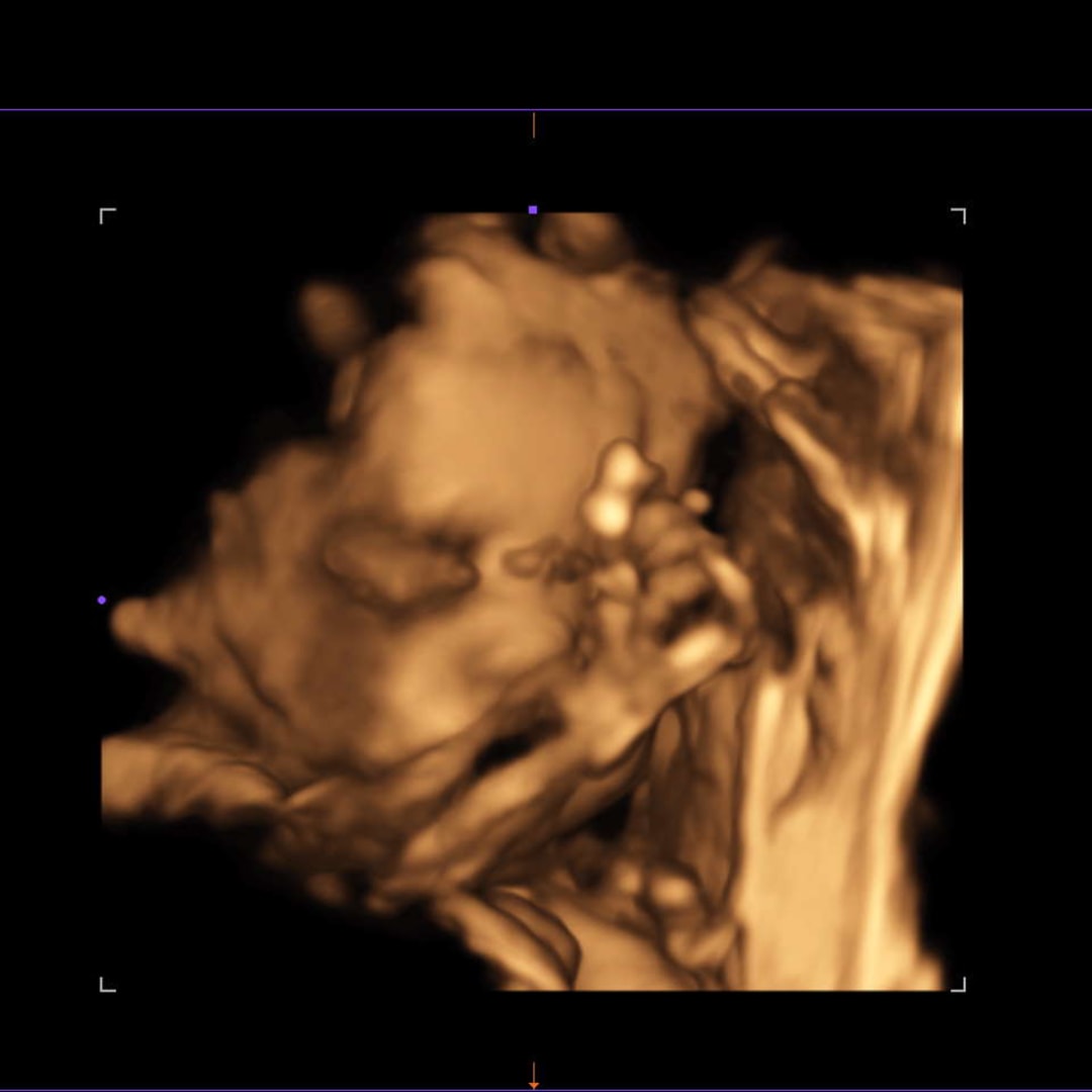 Photo shared by Janifar for their Babylist baby registry.