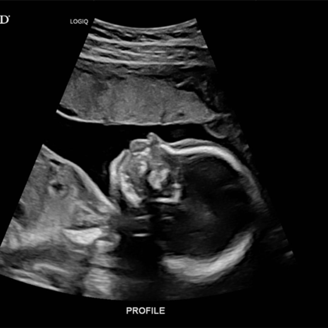 Photo shared by Madison for their Babylist baby registry.