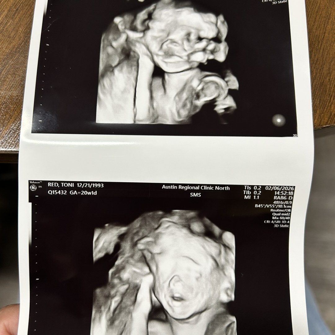 Photo shared by Mark for their Babylist baby registry.