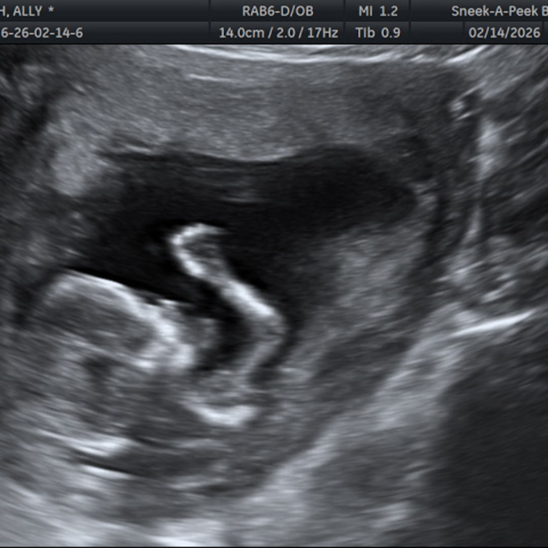 Photo shared by Ally for their Babylist baby registry.