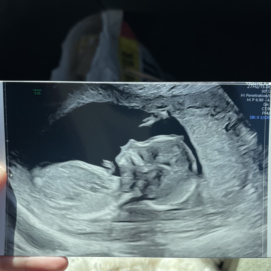 Photo shared by Hannah for their Babylist baby registry.