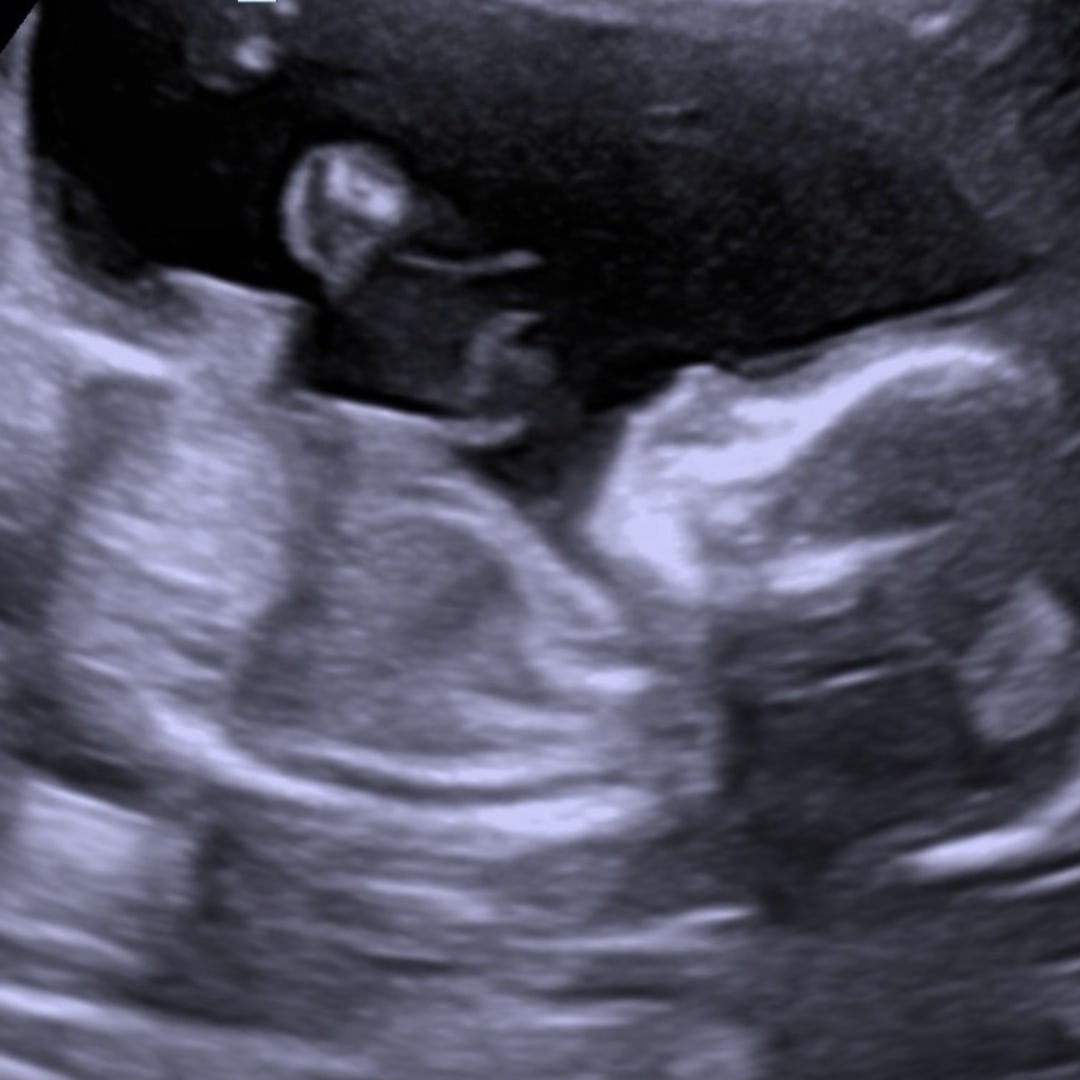 Photo shared by Fatima & Francisco for their Babylist baby registry.