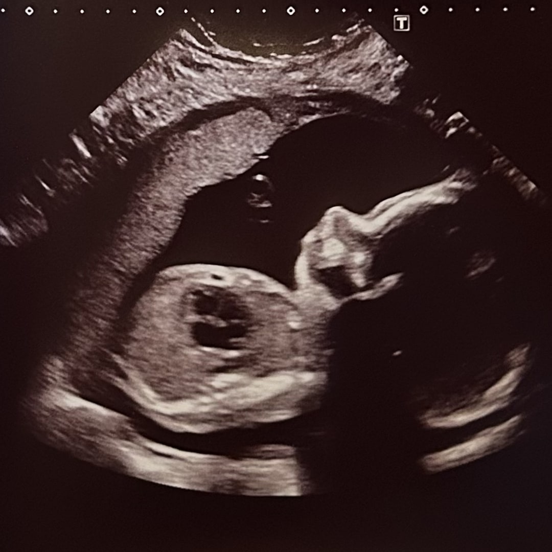 Photo shared by Veda for their Babylist baby registry.