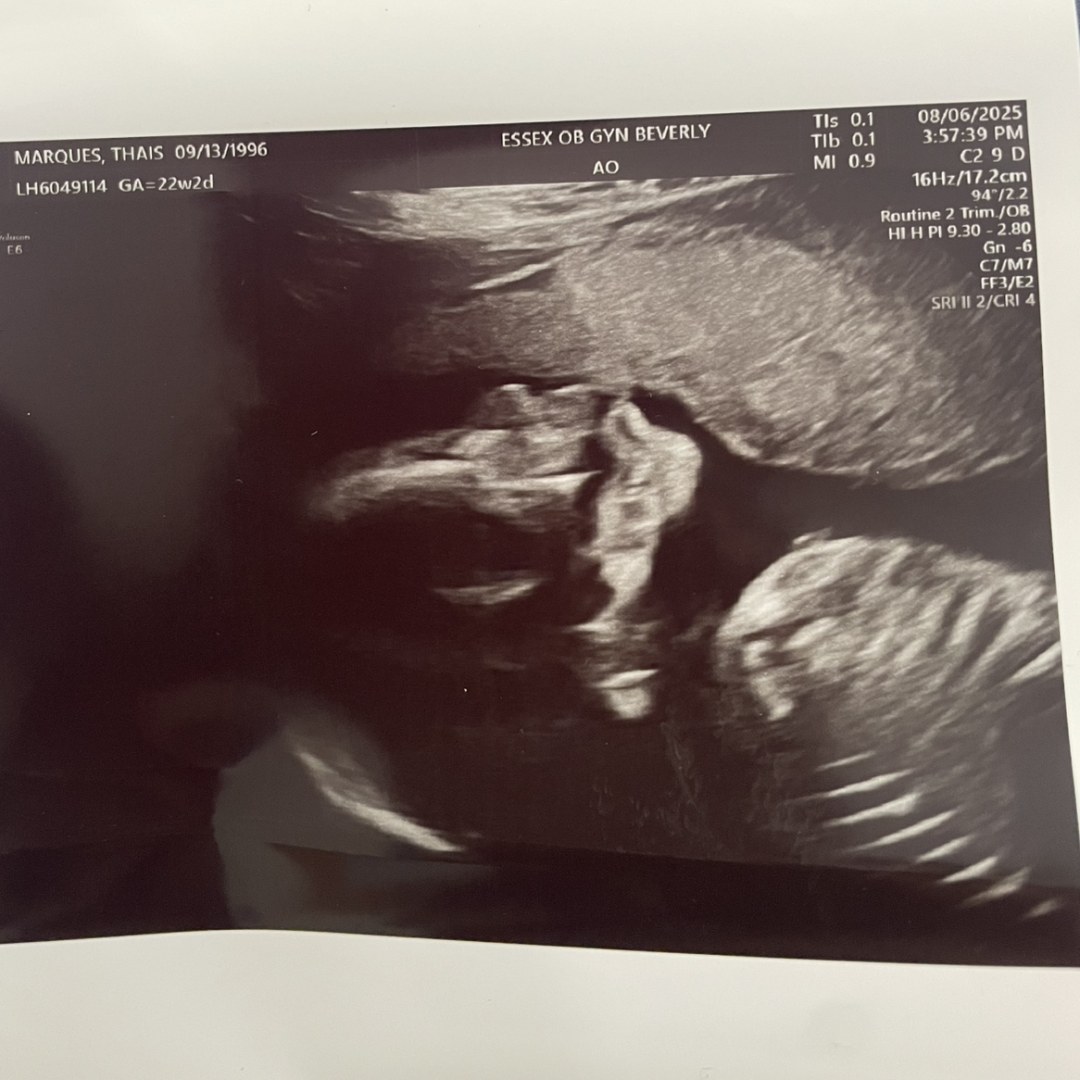 Photo shared by Thais for their Babylist baby registry.