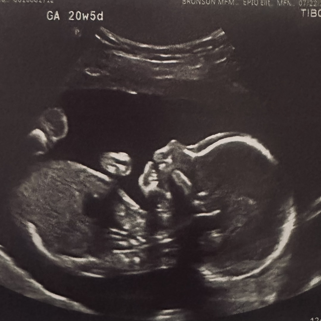 Photo shared by Shannon for their Babylist baby registry.