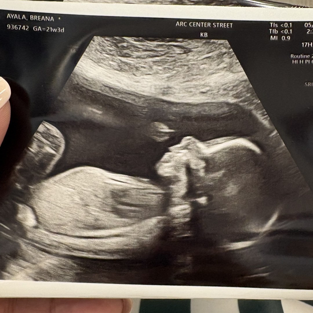 Photo shared by Breana for their Babylist baby registry.