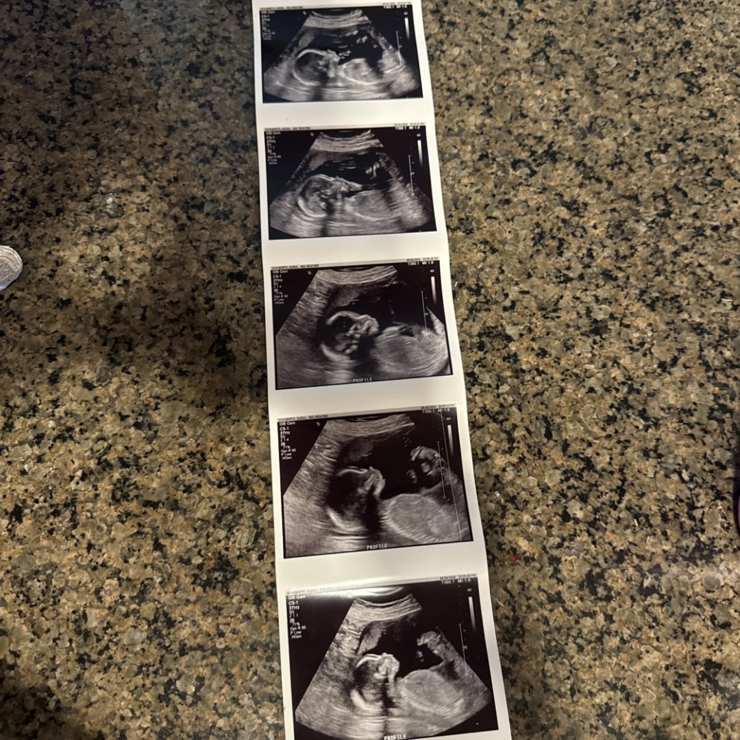 Photo shared by Alena for their Babylist baby registry.