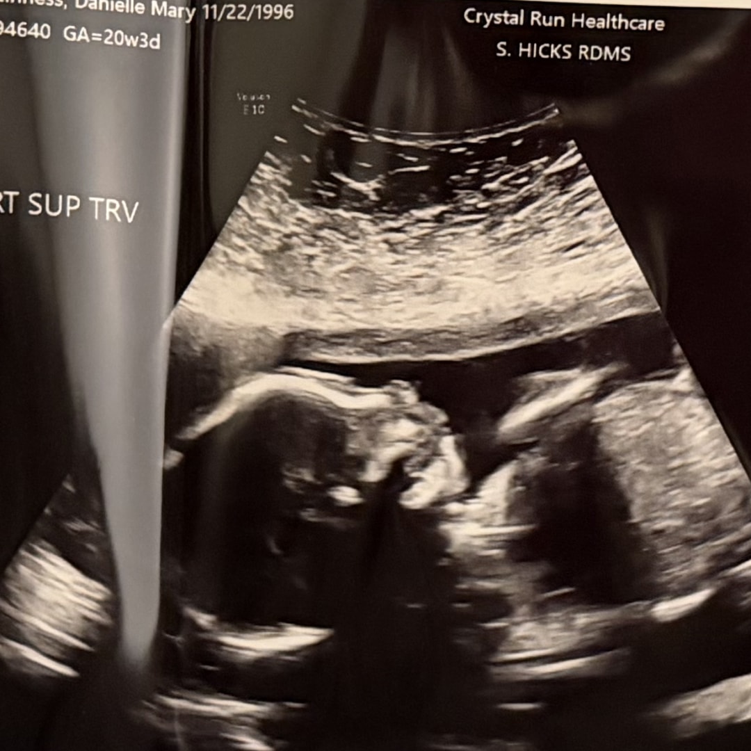 Photo shared by Danielle for their Babylist baby registry.