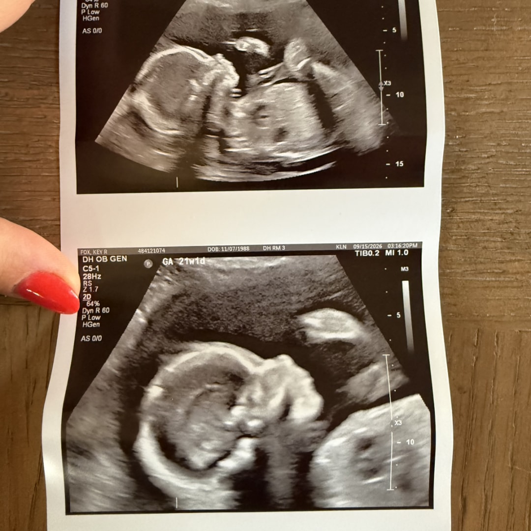 Photo shared by Key for their Babylist baby registry.