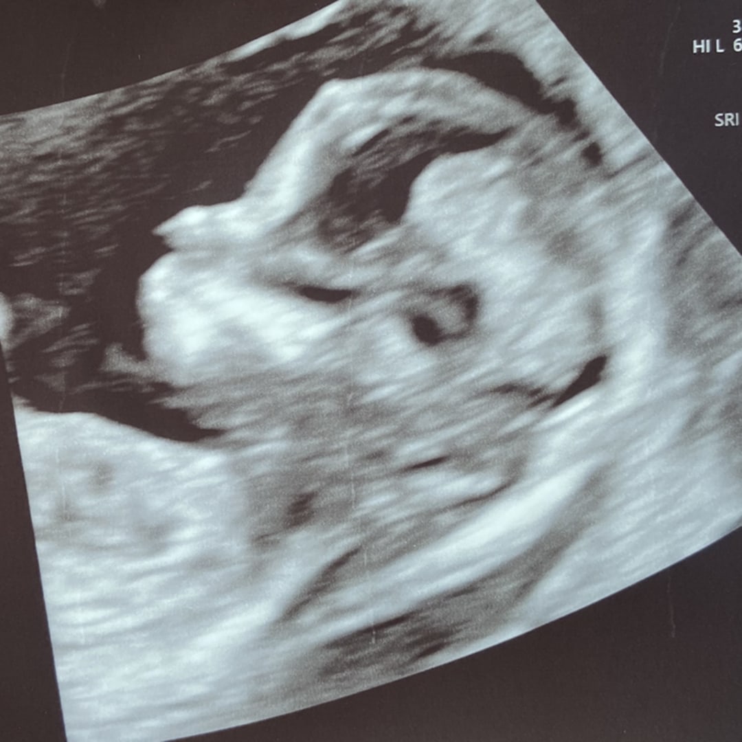 Photo shared by Jodi for their Babylist baby registry.