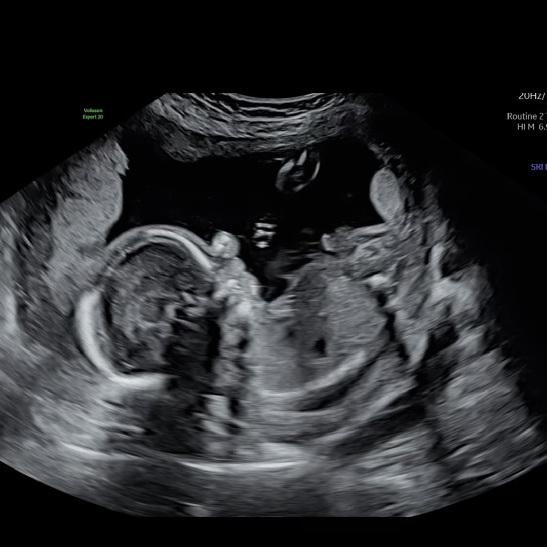 Photo shared by Denae for their Babylist baby registry.