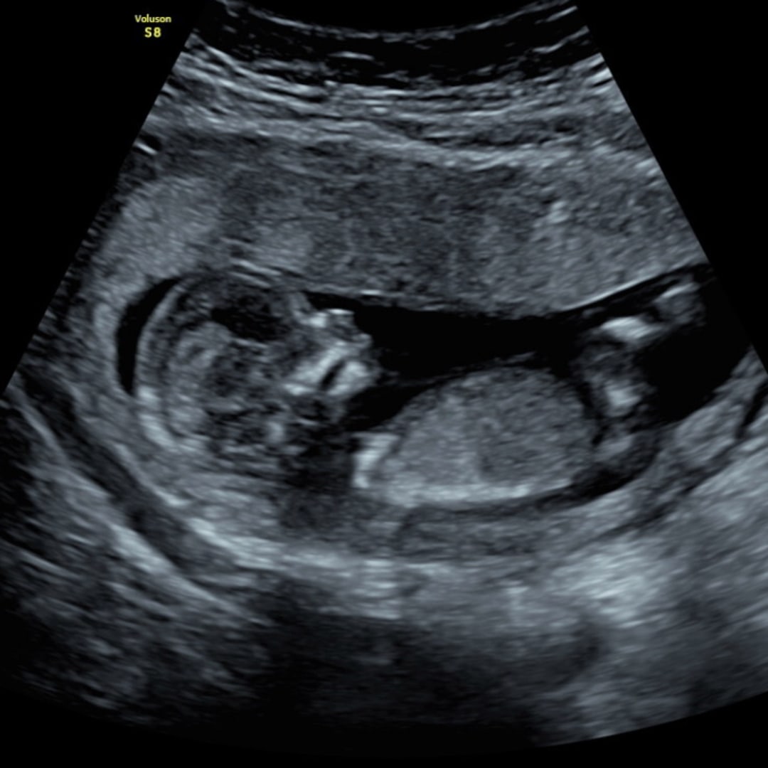 Photo shared by Jaquelyn for their Babylist baby registry.