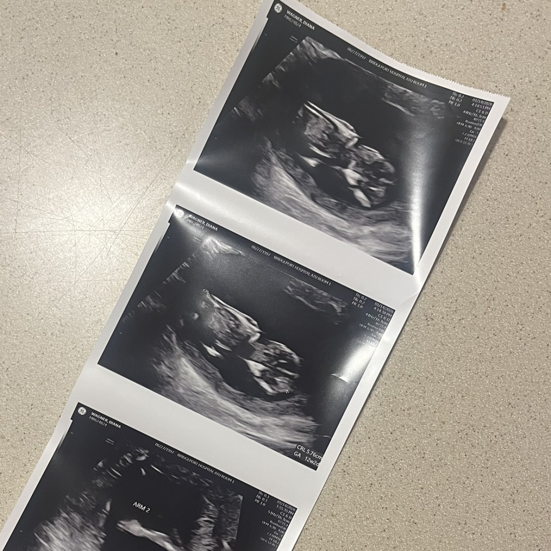 Photo shared by Diana for their Babylist baby registry.