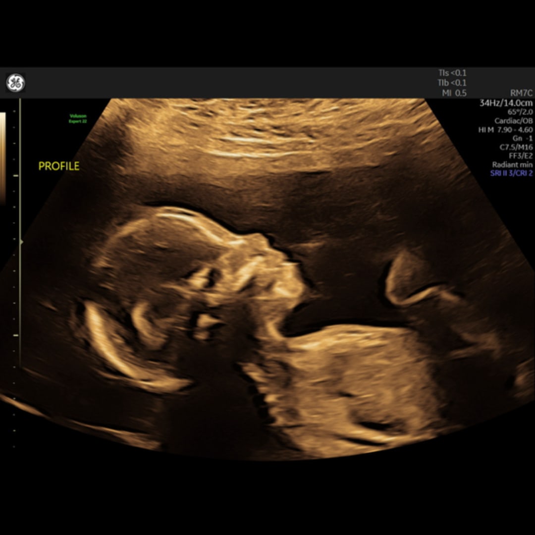 Photo shared by Chelsey for their Babylist baby registry.