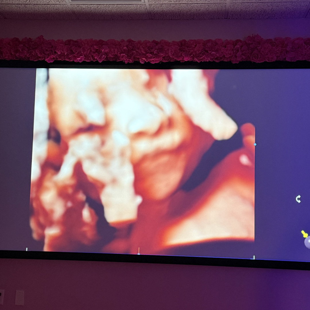 Photo shared by Aileen for their Babylist baby registry.